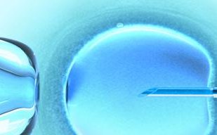 自助赴新加坡试管婴儿全攻略：必知事项与行程指南