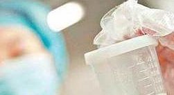 宫腔镜手术对备孕的影响，想生育这些注意事项要知道