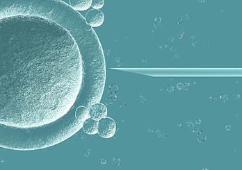 详细解读那曲市做长方案试管婴儿费用，长方案和短方案成功率有差别吗？