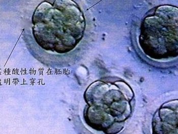 云南热门试管医院整理发布！2026云南三代试管收费指南介绍